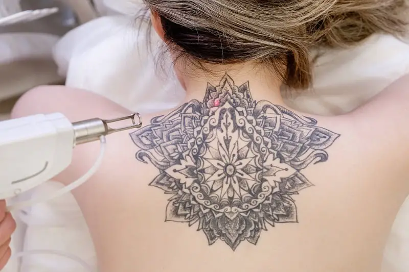 What Happens If A Tattoo Artist Messed Up, saved tattoo, removal