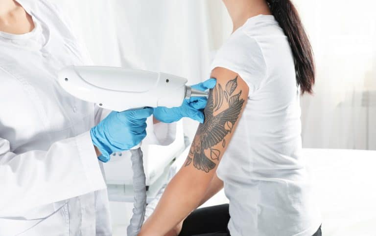 Can a Tattoo Be Removed Naturally?