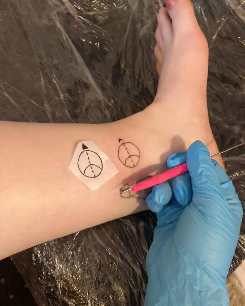 Why Is the Stick-and-Poke Method Used