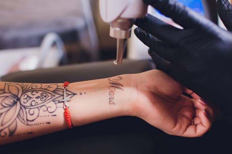 Does Tattoo Removal Cause Scarring: Laser Tattoo Removal and Side Effects